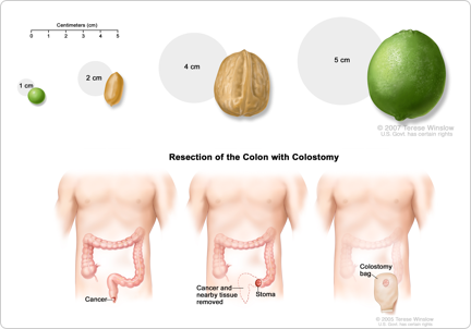 Үлкен балапандармен порно